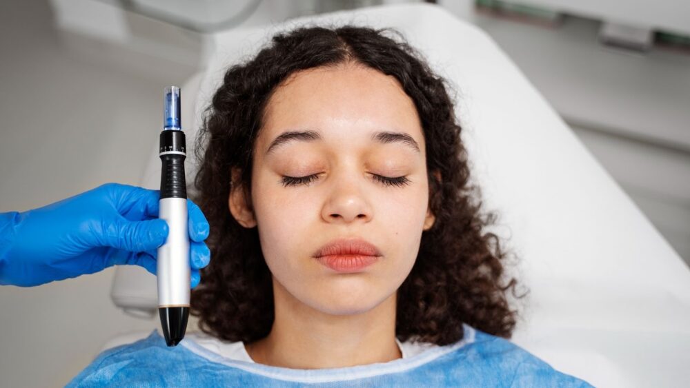 Microneedling Charleston Treatments